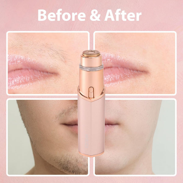 KISS - RED FACIAL HAIR REMOVER ROSE GOLD