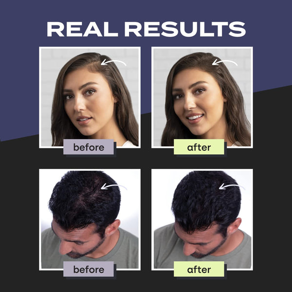 TOPPIK - Hair Building Fiber DARK BROWN