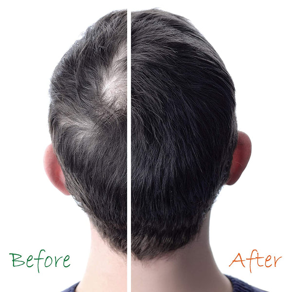 Organic Hair Energizer - Root & Scalp Tonic