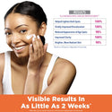 PALMER'S - Skin Success Anti-Dark Spot Fade Cream For Oily Skin
