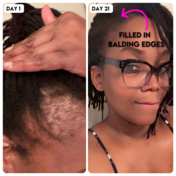 Hollywood Hair Bar - All Natural Extreme Strength Growth Serum