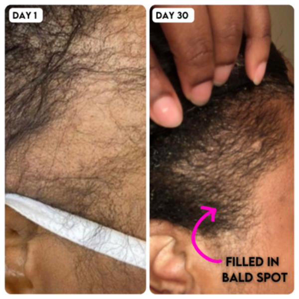 Hollywood Hair Bar - All Natural Extreme Strength Growth Serum
