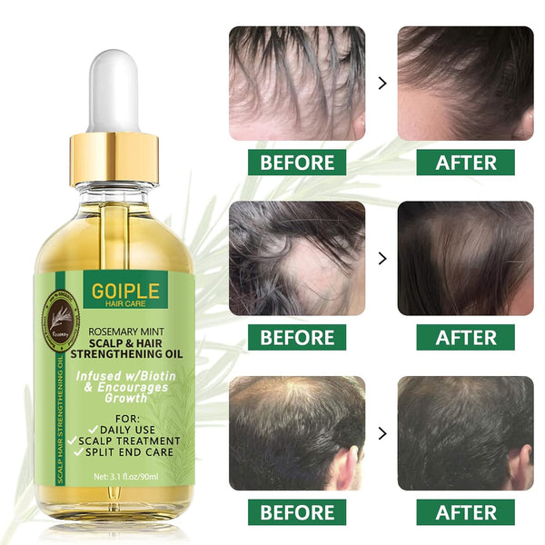 GOIPLE - Organic Rosemary Mint Scalp, Hair Strengthening Oil