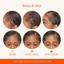 KISS - RED BY KISS MD HAIR & SCALP OIL