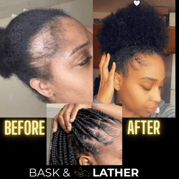 BASK & LATHER - Scalp Stimulator Hair Growth Oil