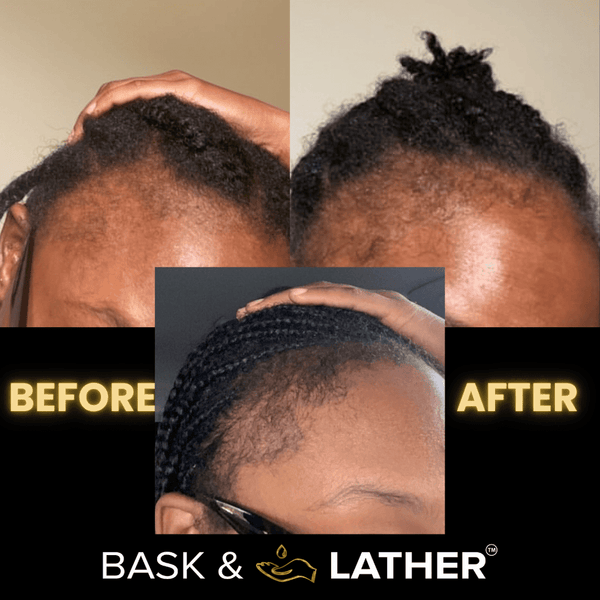 BASK & LATHER - Scalp Stimulator Hair Growth Oil