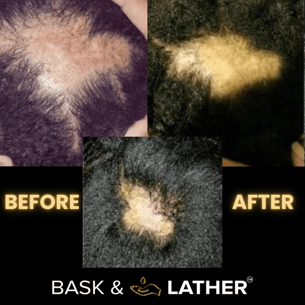 BASK & LATHER - Scalp Stimulator Hair Growth Oil