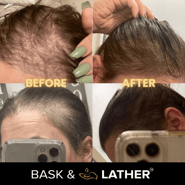 BASK & LATHER - Scalp Stimulator Hair Growth Oil